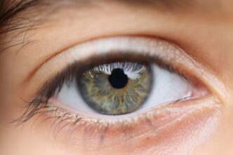 soore eye